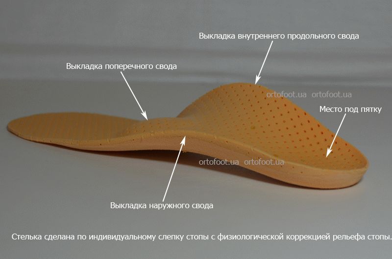 ортопедические стельки в Киеве