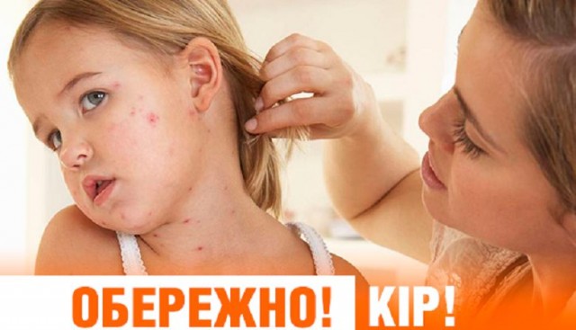 За січень на кір у Дубні захворіло близько 40 людей