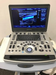 Mindray M8 Elite Ultrasound Machine