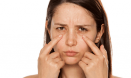 thermage for eyes